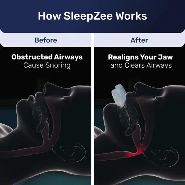 SleepZee image